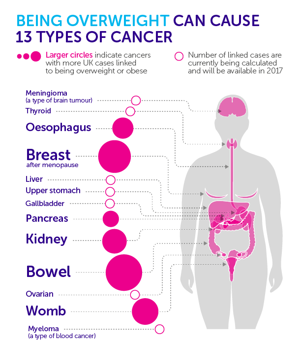 OBESITY, OVERWEIGHT AND CANCER